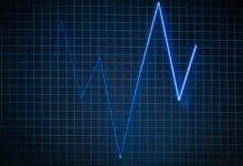 data pulse overview report